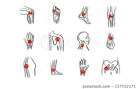 Arthritis Sketch Poster 137552171