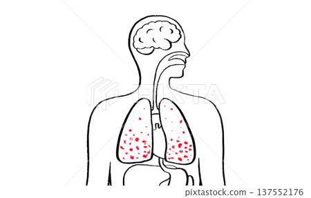 Lung disease concept Lung disease concept 137552176