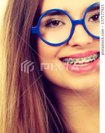 Nerdy woman showing her teeth with braces Nerdy woman showing her teeth with braces 137577925
