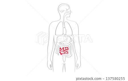 Intestine diseases sketch 137580255