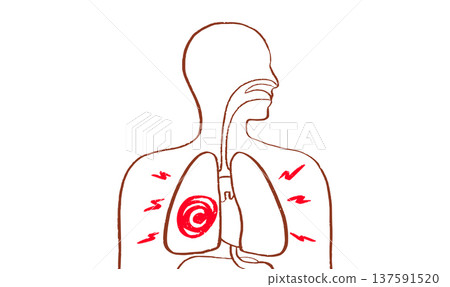 Lung disease concept Lung disease concept 137591520