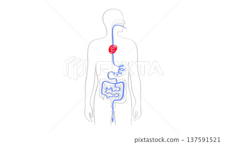 Esophagus pain diagram 137591521