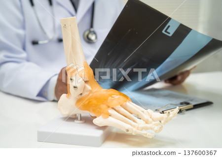 Doctor examining foot ankle  joint bone radiography xray film. 137600367
