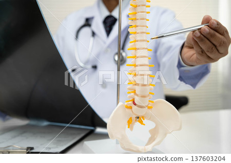 Doctor examining spine bone radiography xray film. 137603204