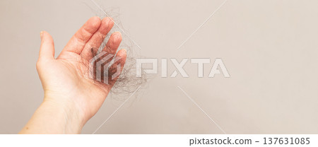 close up photo of female hand holding lost hair in hand on a beige background. 137631085