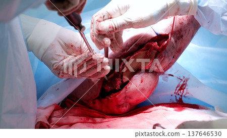 Medical professionals working diligently during a surgical procedure, focusing on a patient's leg with precision and care in an intense hospital operating room Medical professionals working diligently during a surgical procedure, focusing on a patient's leg with precision and care in an intense hospital operating room 137646530