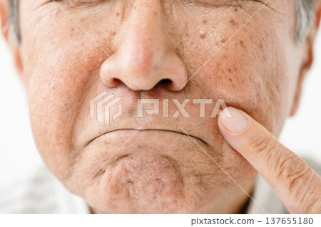 老年男性有法令紋 137655180