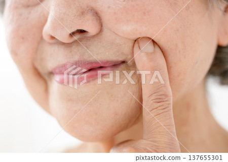 Senior woman nasolabial folds Senior woman nasolabial folds 137655301