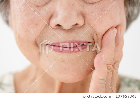 Senior woman nasolabial folds 137655305