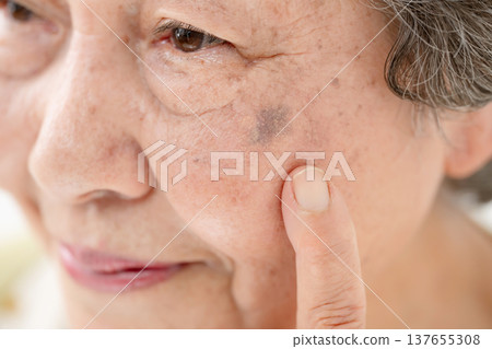 Senior women, age spots 137655308