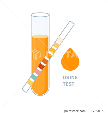 Urine sample tube and urinalysis reagent strip for kidney exam, urinary tract infection and cystitis diagnostics.  137690150