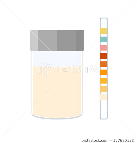 Urine sample cup and urinalysis reagent strip for kidney exam, urinary tract infection and cystitis diagnostics. Urine sample cup and urinalysis reagent strip for kidney exam, urinary tract infection and cystitis diagnostics. 137690158