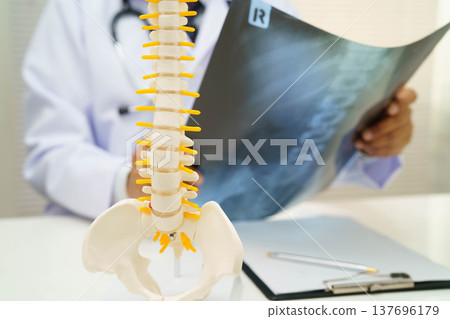 Doctor examining spine bone radiography xray film. Doctor examining spine bone radiography xray film. 137696179