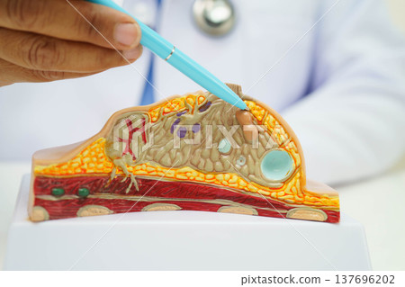 doctor holding female breast human anatomy model. 137696202