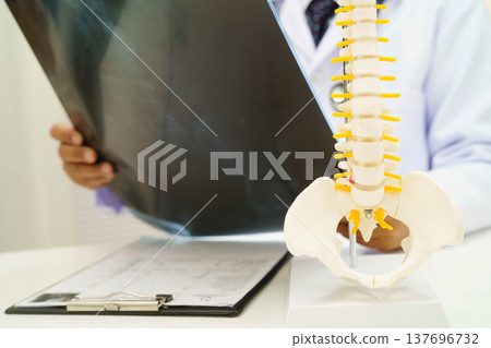 Doctor examining spine bone radiography xray film. 137696732