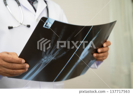 Doctor examining hand ankle joint bone radiography xray film. Doctor examining hand ankle joint bone radiography xray film. 137717563