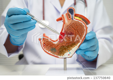 Stomach disease, doctor with anatomy model for study diagnosis and treatment in hospital. 137750640