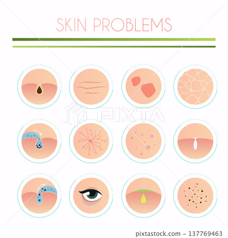 Skin problems solution, home remedies. Skincare and dermatology concept. Flat design modern vector illustration concept. Skin problems solution, home remedies. Skincare and dermatology concept. Flat design modern vector illustration concept. 137769463
