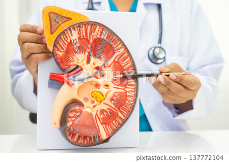 Chronic kidney disease, doctor with model for treatment urinary system, urology, Estimated glomerular filtration rate eGFR. Chronic kidney disease, doctor with model for treatment urinary system, urology, Estimated glomerular filtration rate eGFR. 137772104