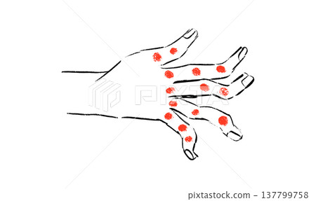 Arthritis Sketch Poster Arthritis Sketch Poster 137799758