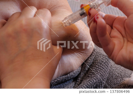 Woman is injecting hormones to belly with syringe. IVF concept close up Woman is injecting hormones to belly with syringe. IVF concept close up 137806496