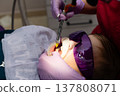 Bright lights and careful hands work to treat a young patient during a dental checkup in a modern clinic in the afternoon 137808071