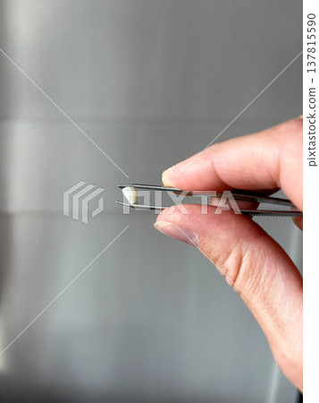 A mother's hand holds her child's lost tooth with tweezers 137815590