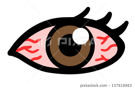 一組關於眼睛充血的插圖:眼睛疲勞、花粉症和眼部疾病。 一組關於眼睛充血的插圖:眼睛疲勞、花粉症和眼部疾病。 137818983