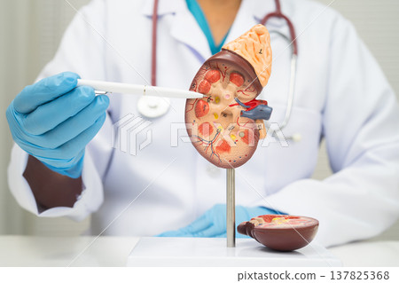 Chronic kidney disease, doctor with model for treatment urinary system, urology, Estimated glomerular filtration rate eGFR. 137825368