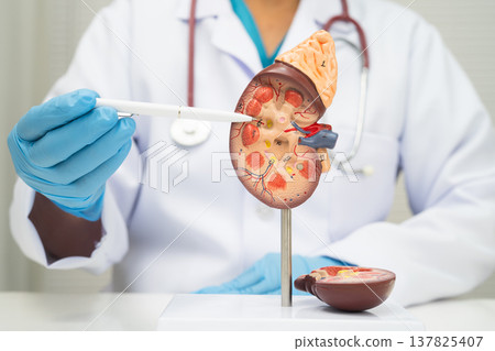 Chronic kidney disease, doctor with model for treatment urinary system, urology, Estimated glomerular filtration rate eGFR. Chronic kidney disease, doctor with model for treatment urinary system, urology, Estimated glomerular filtration rate eGFR. 137825407