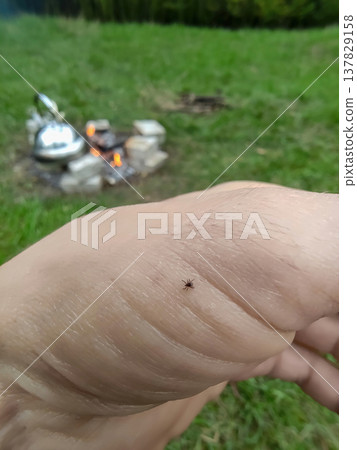 tick is crawling along a human skin in camp. A parasite spreading viruses of dangerous diseases like a meningitis and a Borreliosis Lyme disease. Ixodes, genus of hard-bodied ticks. tick is crawling along a human skin in camp. A parasite spreading viruses of dangerous diseases like a meningitis and a Borreliosis Lyme disease. Ixodes, genus of hard-bodied ticks. 137829158