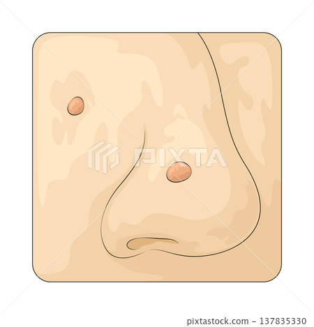 Illustration of Acne 137835330