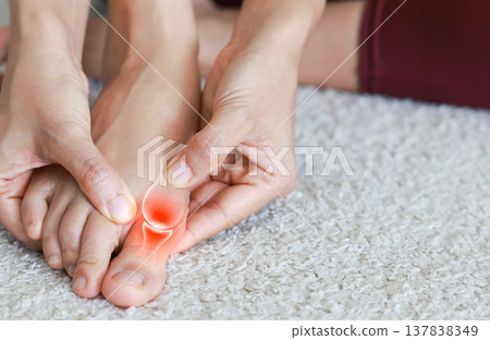 Close up of woman massaging painful big toe with anatomical joint illustration and red highlight. Hallux valgus, gout, bunion and bone inflammation concept for medical health care. Close up of woman massaging painful big toe with anatomical joint illustration and red highlight. Hallux valgus, gout, bunion and bone inflammation concept for medical health care. 137838349