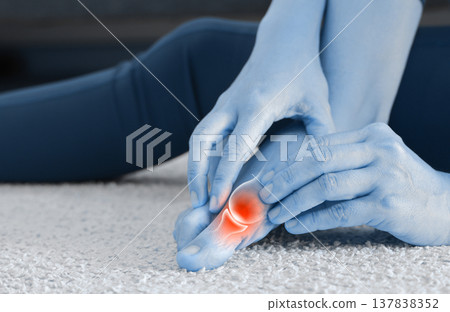 Close up of woman massaging painful big toe with anatomical joint illustration and red highlight. Hallux valgus, gout, bunion and bone inflammation concept for medical health care. 137838352