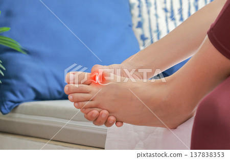 Close up of woman massaging painful big toe with anatomical joint illustration and red highlight. Hallux valgus, gout, bunion and bone inflammation concept for medical health care. Close up of woman massaging painful big toe with anatomical joint illustration and red highlight. Hallux valgus, gout, bunion and bone inflammation concept for medical health care. 137838353