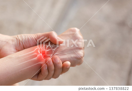 Woman massaging her painful wrist with anatomical bone illustration and red highlight. Carpal tunnel syndrome, wrist fracture, arthritis and joint inflammation concept for medical health care. Woman massaging her painful wrist with anatomical bone illustration and red highlight. Carpal tunnel syndrome, wrist fracture, arthritis and joint inflammation concept for medical health care. 137838822