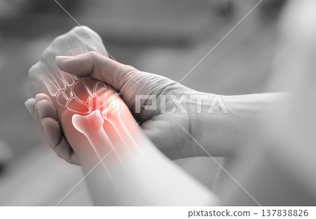 Woman massaging her painful wrist with anatomical bone illustration and red highlight. Carpal tunnel syndrome, wrist fracture, arthritis and joint inflammation concept for medical health care. Woman massaging her painful wrist with anatomical bone illustration and red highlight. Carpal tunnel syndrome, wrist fracture, arthritis and joint inflammation concept for medical health care. 137838826