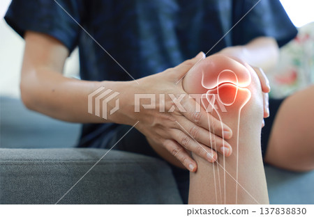 Woman massaging her painful knee with anatomical joint and bone illustration. Knee osteoarthritis, patellar tendonitis, meniscus tear and inflammation concept for medical health care. Woman massaging her painful knee with anatomical joint and bone illustration. Knee osteoarthritis, patellar tendonitis, meniscus tear and inflammation concept for medical health care. 137838830