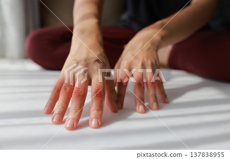 Close up of woman hands with red highlight on finger joints. Rheumatoid arthritis, gout, osteoarthritis and peripheral neuropathy concept for health care, medical treatment and bone disease. Close up of woman hands with red highlight on finger joints. Rheumatoid arthritis, gout, osteoarthritis and peripheral neuropathy concept for health care, medical treatment and bone disease. 137838955