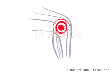 Arthritis Sketch Poster Arthritis Sketch Poster 137841466