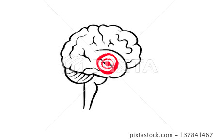 Brain disease concept 137841467