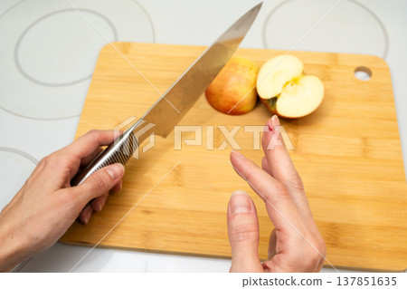 A close-up of hands with a cut finger and a drop of blood on a cutting board with a sliced apple and knife on a kitchen counter first aid health safety accident cooking concept A close-up of hands with a cut finger and a drop of blood on a cutting board with a sliced apple and knife on a kitchen counter first aid health safety accident cooking concept 137851635