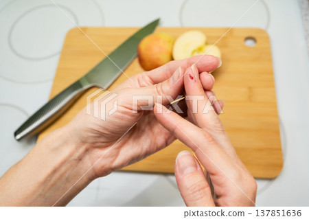 A close-up of hands examining a cut finger with a drop of blood near a cutting board with an apple and knife on a kitchen counter first aid health safety accident cooking concept A close-up of hands examining a cut finger with a drop of blood near a cutting board with an apple and knife on a kitchen counter first aid health safety accident cooking concept 137851636