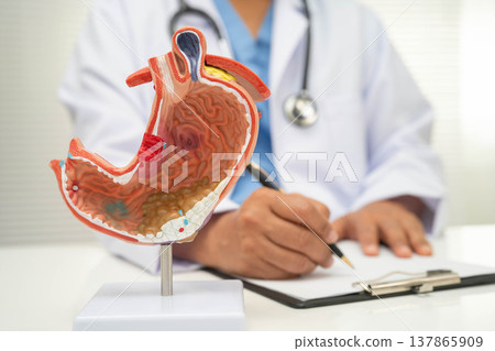 Stomach disease, doctor with anatomy model for study diagnosis and treatment in hospital. 137865909
