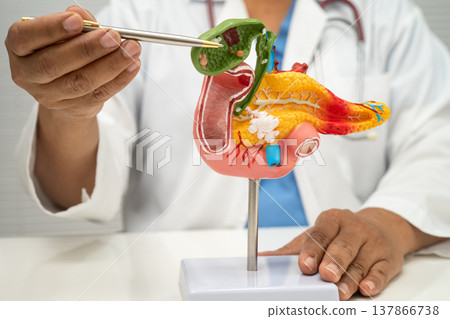 Pancreatitis, pancreatic cancer, Asian doctor with pancreas, gallbladder and bile duct human anatomy model at hospital. Pancreatitis, pancreatic cancer, Asian doctor with pancreas, gallbladder and bile duct human anatomy model at hospital. 137866738