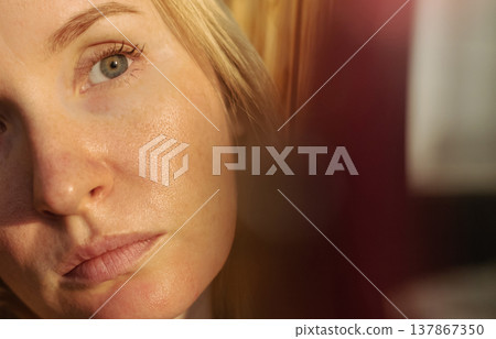 Close-up of female face with enlarged pores and oily skin, visible texture, redness on chin. Natural light beauty portrait, skincare concerns, dermatology concept. Close-up of female face with enlarged pores and oily skin, visible texture, redness on chin. Natural light beauty portrait, skincare concerns, dermatology concept. 137867350