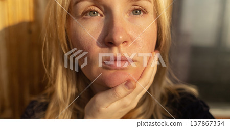 Close-up of female face with enlarged pores and oily skin, visible texture, redness on chin. Natural light beauty portrait, skincare concerns, dermatology concept. Close-up of female face with enlarged pores and oily skin, visible texture, redness on chin. Natural light beauty portrait, skincare concerns, dermatology concept. 137867354