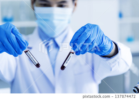 Close up Scientist man hands holding sample blood test tube science laboratory. Doctor clinic healthcare technician lab testing blood sample diagnosis. Crop man scientist hands testing medical lab Close up Scientist man hands holding sample blood test tube science laboratory. Doctor clinic healthcare technician lab testing blood sample diagnosis. Crop man scientist hands testing medical lab 137874472