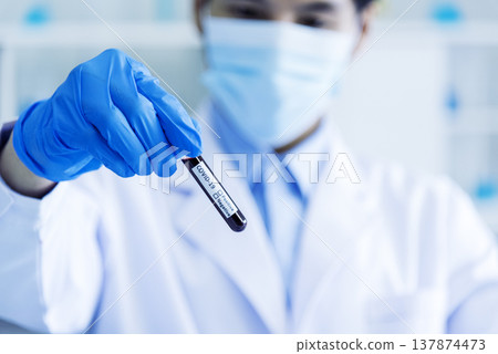 Close up Scientist man hands holding sample blood test tube science laboratory. Doctor clinic healthcare technician lab testing blood sample diagnosis. Crop man scientist hands testing medical lab Close up Scientist man hands holding sample blood test tube science laboratory. Doctor clinic healthcare technician lab testing blood sample diagnosis. Crop man scientist hands testing medical lab 137874473