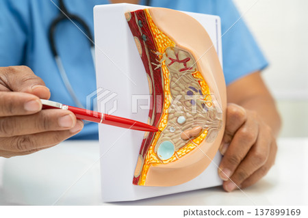 doctor holding female breast human anatomy model. 137899169